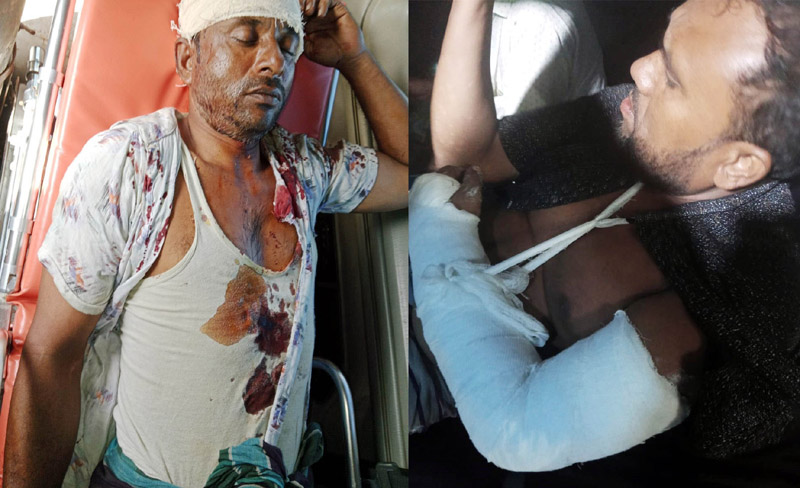 চকিয়া বিলে পাহারাদারের ওপর মাছ চোরদের হামলা