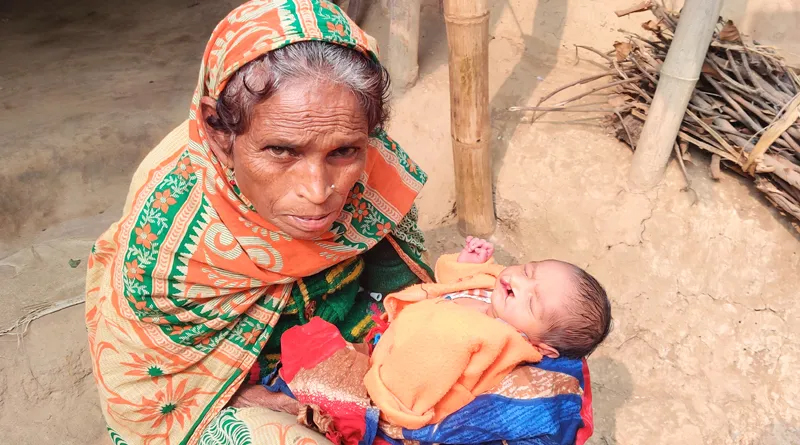 মলদ্বার ও ঠোঁট বিহীন নবজাতকের জন্ম, বিপাকে দরিদ্র পরিবার