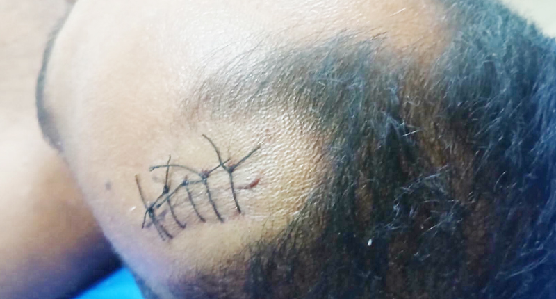 শ্রীমঙ্গলে কথা কাটাকাটির জেরে যুবক নিহত