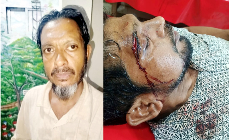 মাদক সেবনে বাধা দেয়ায় বড় ভাই আহত